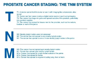 Лечение РПЖ на поздних стадиях tnm